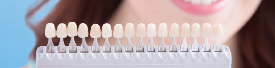teeth whitening options and safety