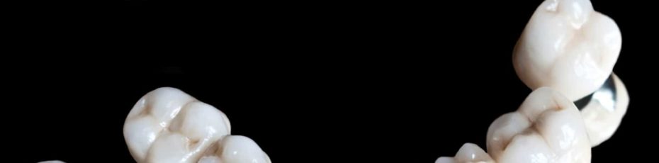 dental crowns in davie