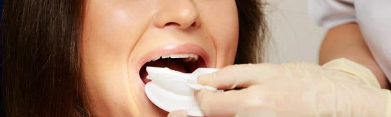 fluoride applications in davie