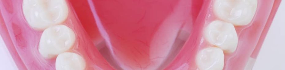 tooth-colored fillings in davie