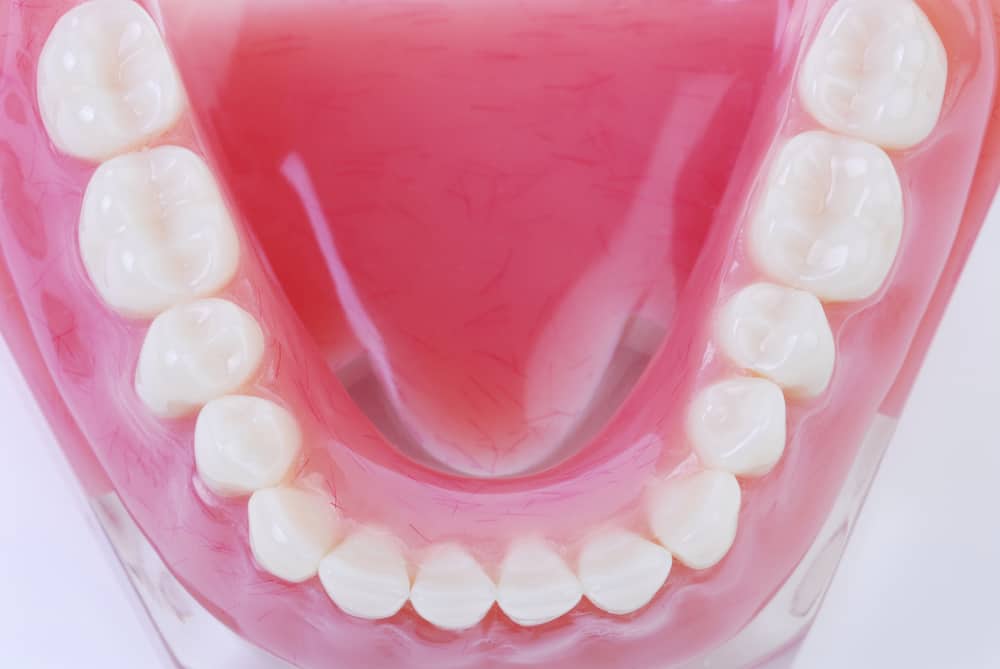 tooth-colored fillings in davie