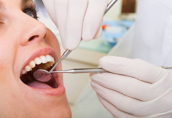 tooth extraction in davie