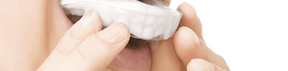 the straightforward guide to choosing the right mouthguard