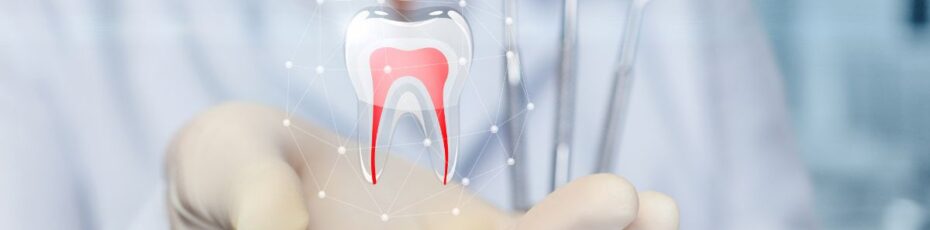 5 things you need to know about root canals