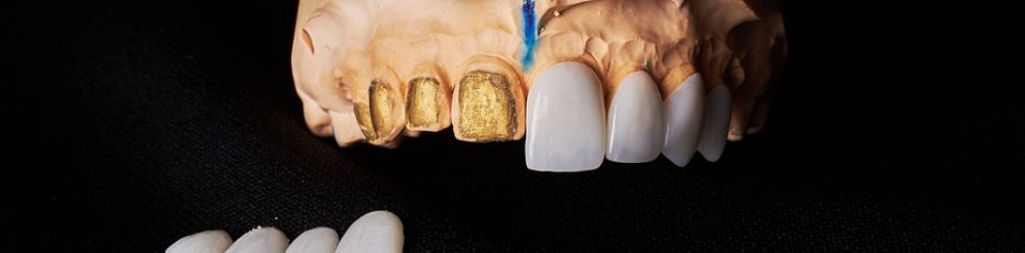 dental bonding for chipped or gapped teeth
