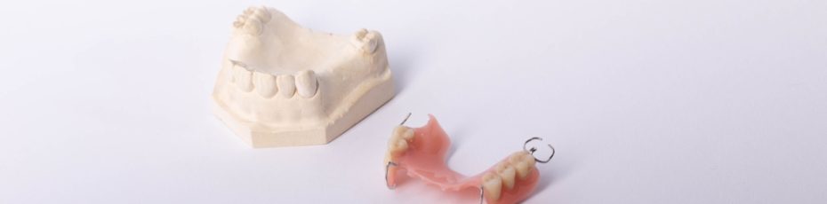 difference between dental bridges and dentures