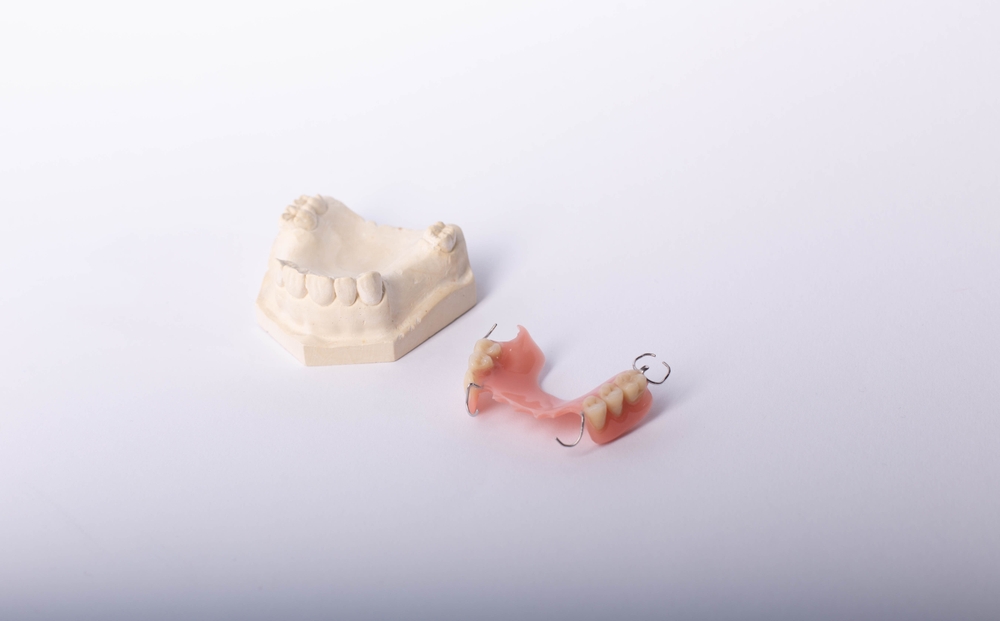 difference between dental bridges and dentures