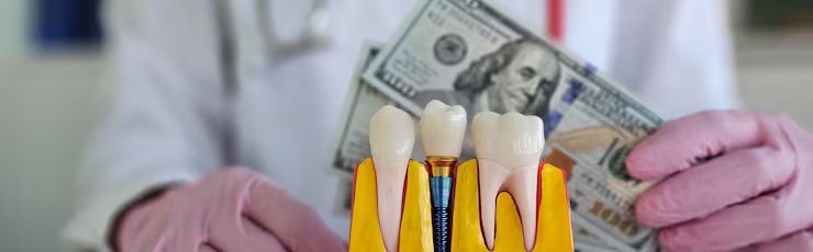 Dentist explaining dental implant costs