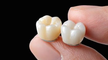 CEREC same-day crowns